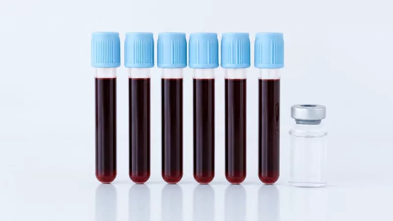 Tubos de tapón azul con muestra de sangre para pruebas de coagulación junto a un vial de reactivo liofilizado